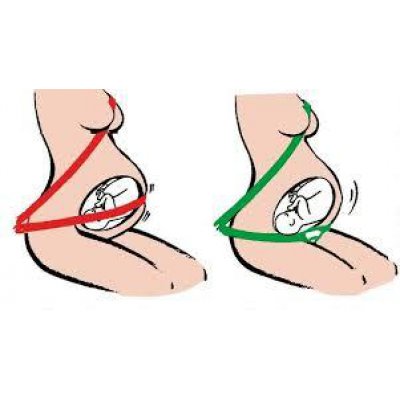 BeSafe Pregnant iZi fix bezpečnostní pás pro těhotné - obrázek